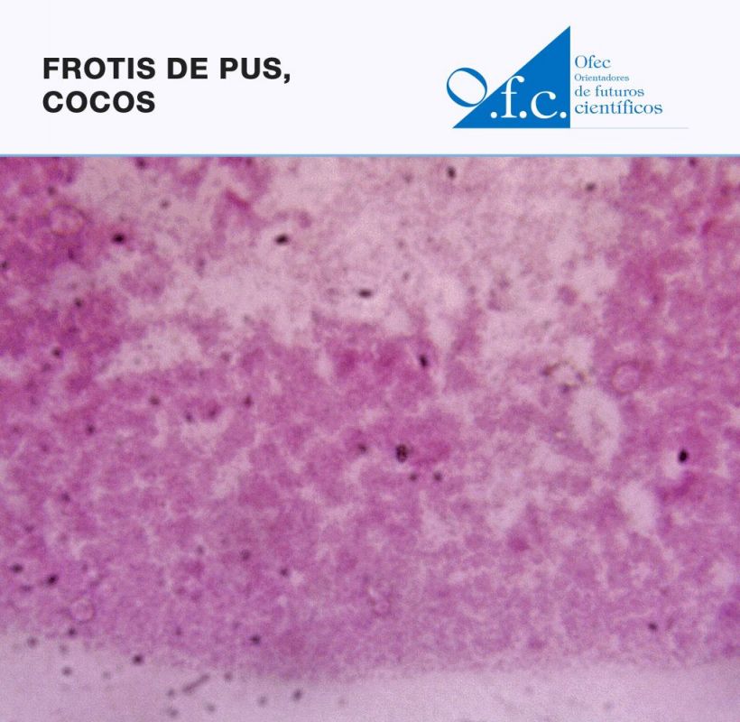 Frotis de pus, cocos