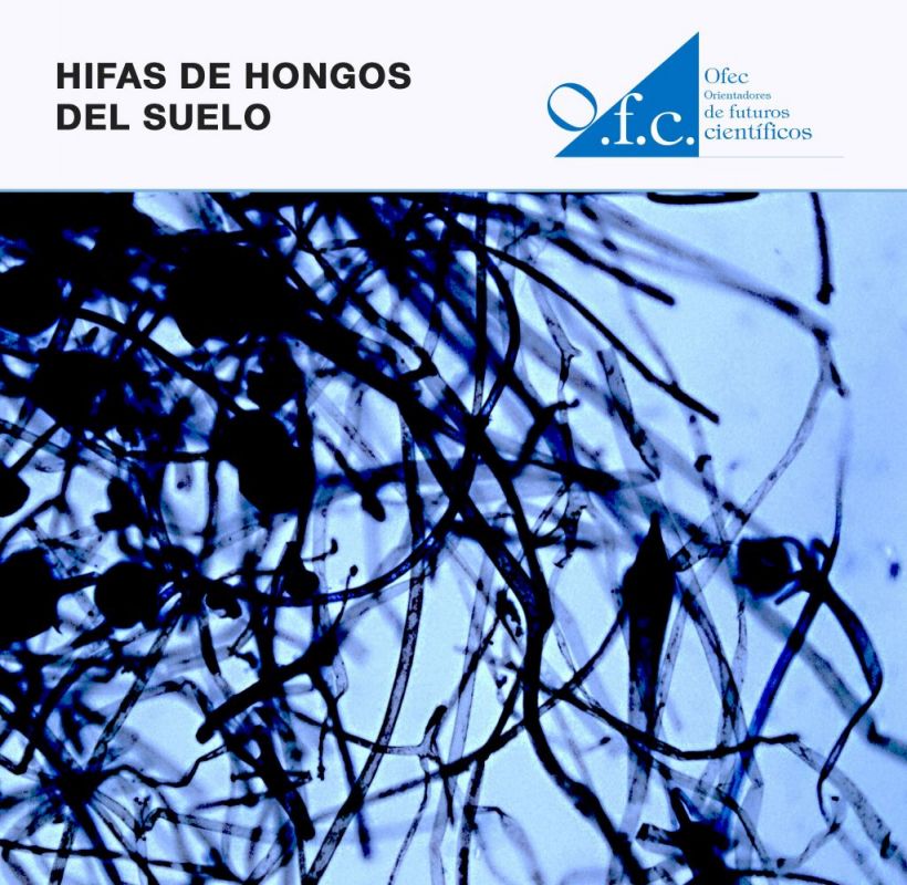 Hifas de hongos del suelo