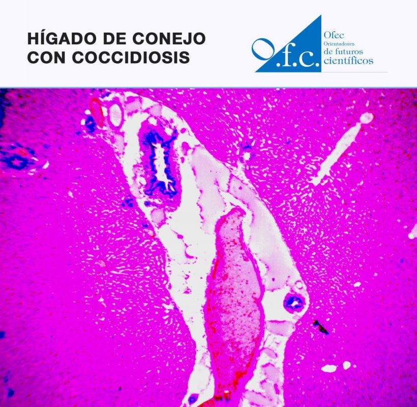 Hígado de conejo con coccidiosis