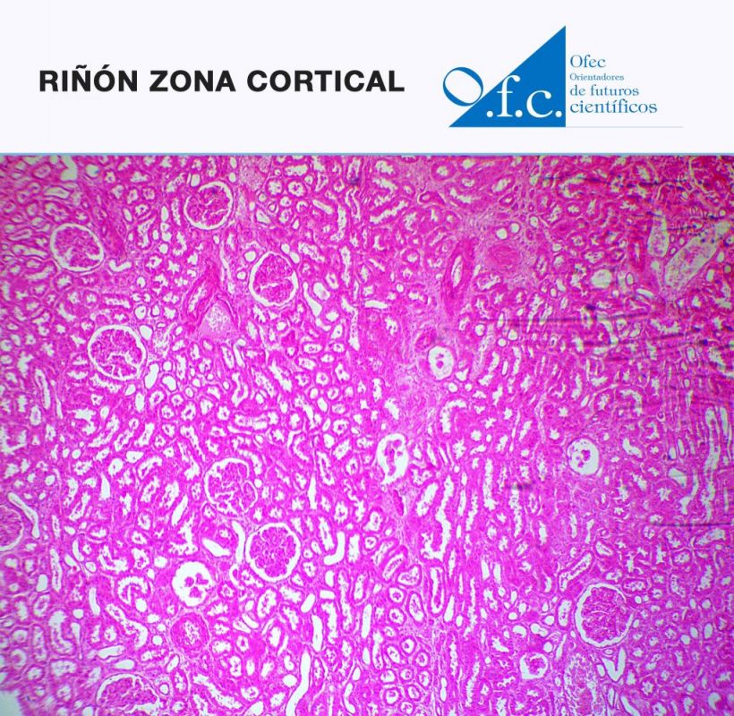 Riñón zona cortical  