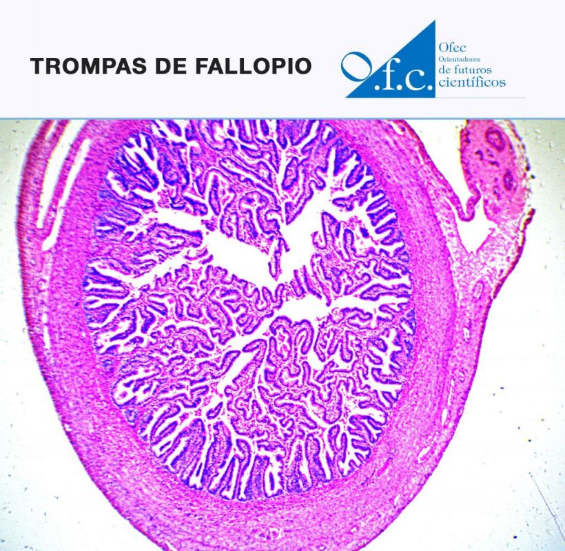 Trompas de fallopio