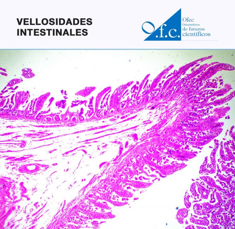 Vellosidades intestinales